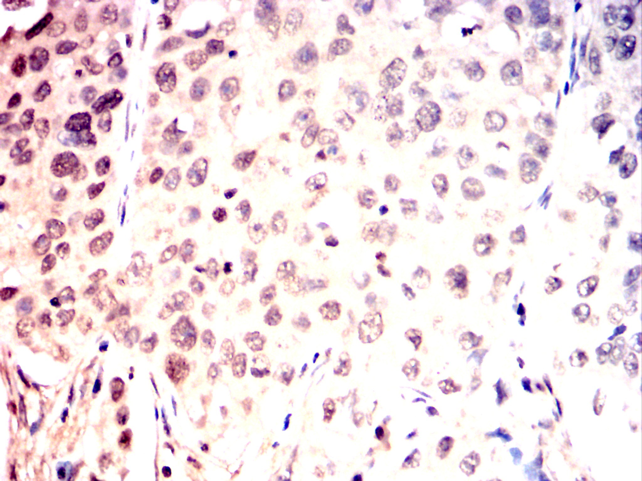 		IHC